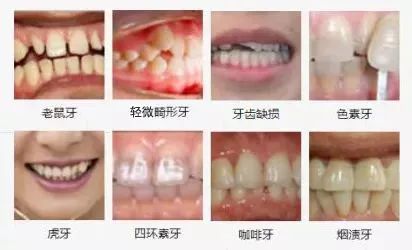 牙齿质量不好，影响、原因及改善方法