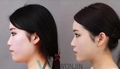 鼻子的奥秘与魅力