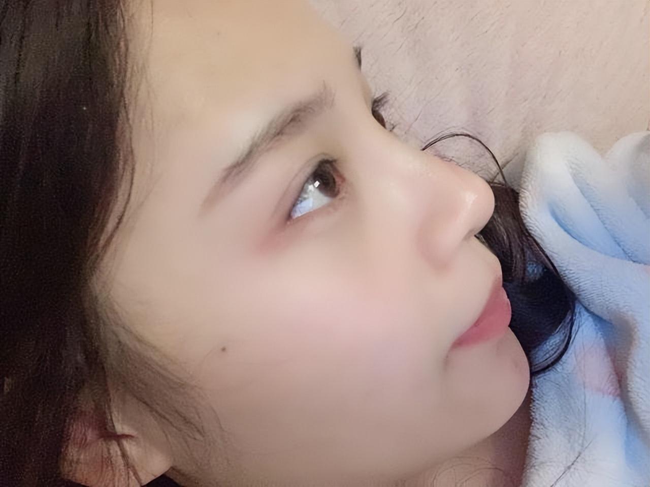 鼻子两侧发红的原因及应对方法